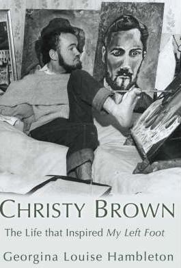Christy Brown: The life that inspired My left Foot